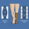 An illustration of Varicose veins and Compressed veins. Showing how compression socks help in the management of varicose veins.