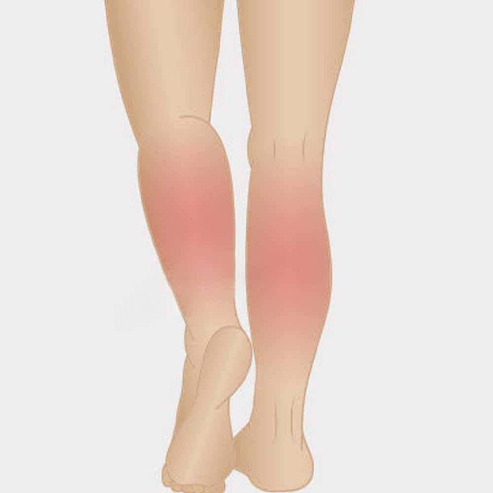 Image showing inflammation in the legs